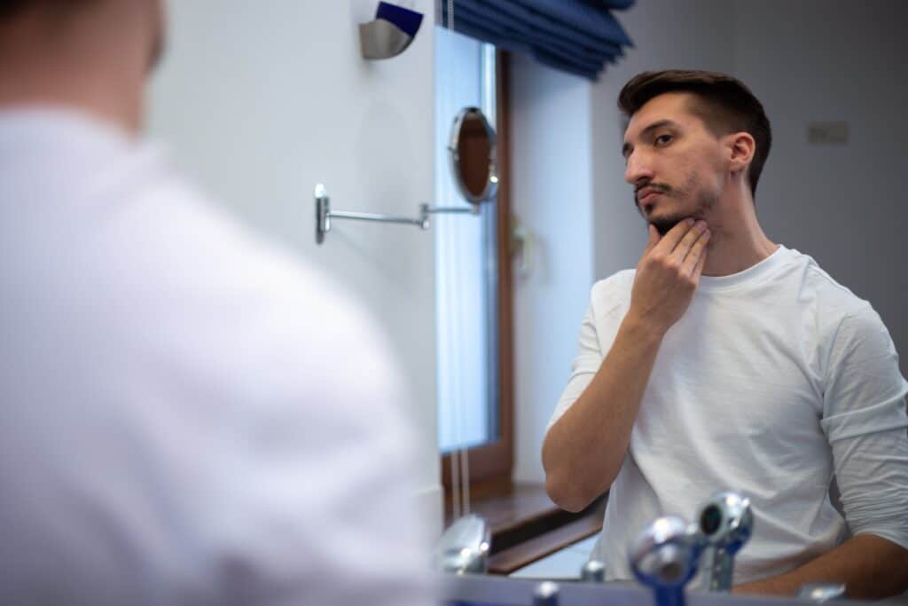 A man with a alopecia barbae looks in the mirror