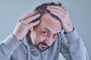 Man looking at hairline to see if he has frontal fibrosing alopecia