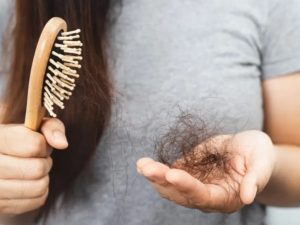 hair loss women