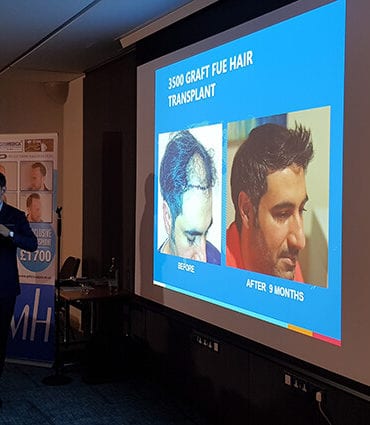 hair transplant seminar in london