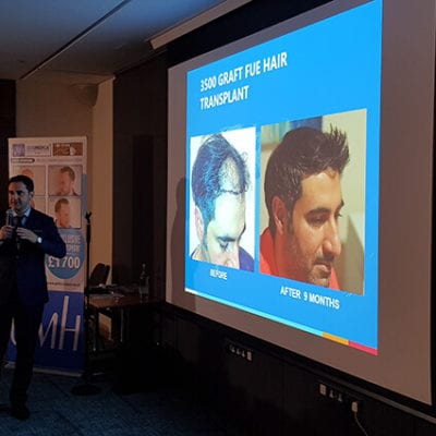 hair transplant seminar in london