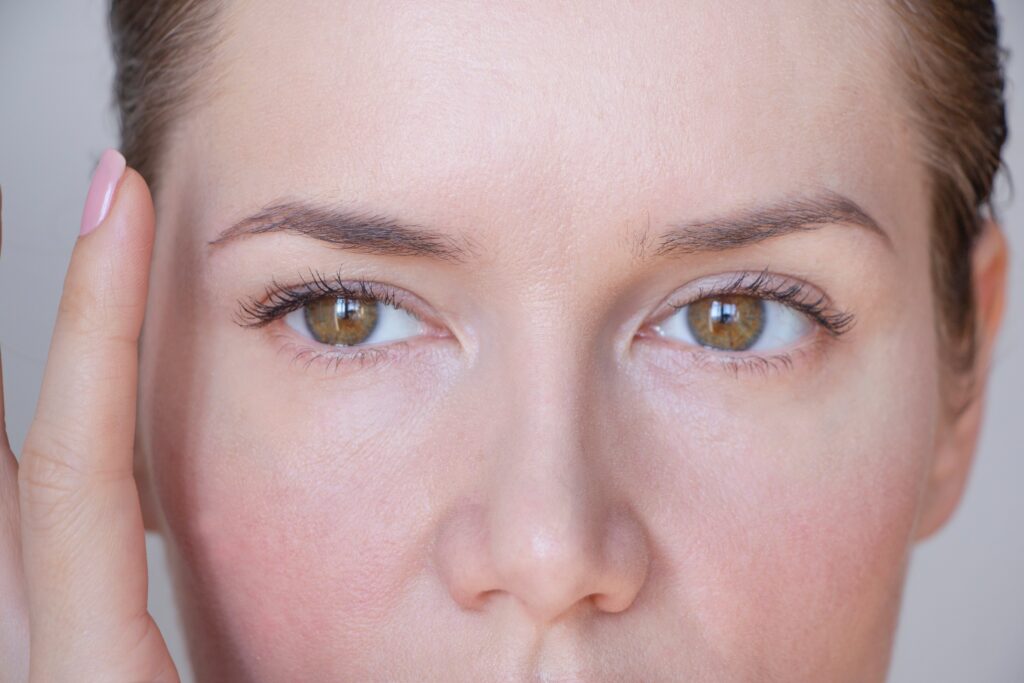 Woman with thinning eyebrows