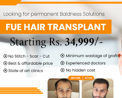 Hair Transplant in Bhopal