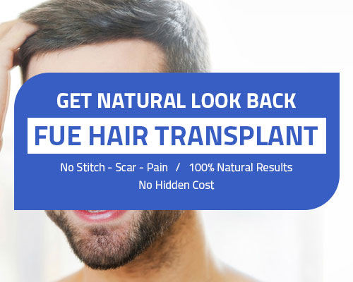 Hair Transplant in Indore