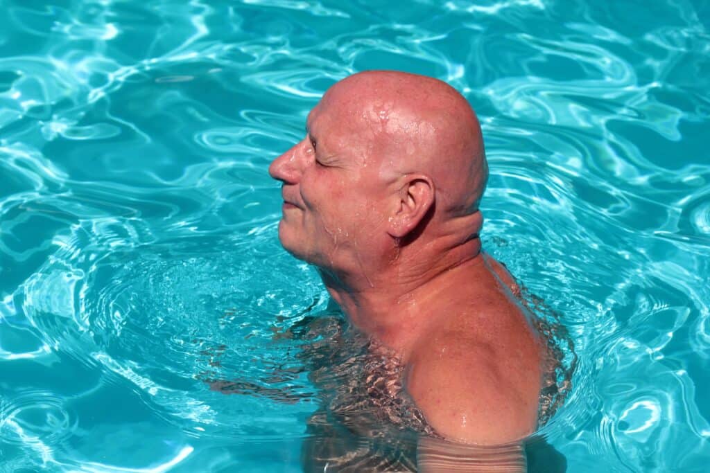 Homme en été souffrant de perte de cheveux