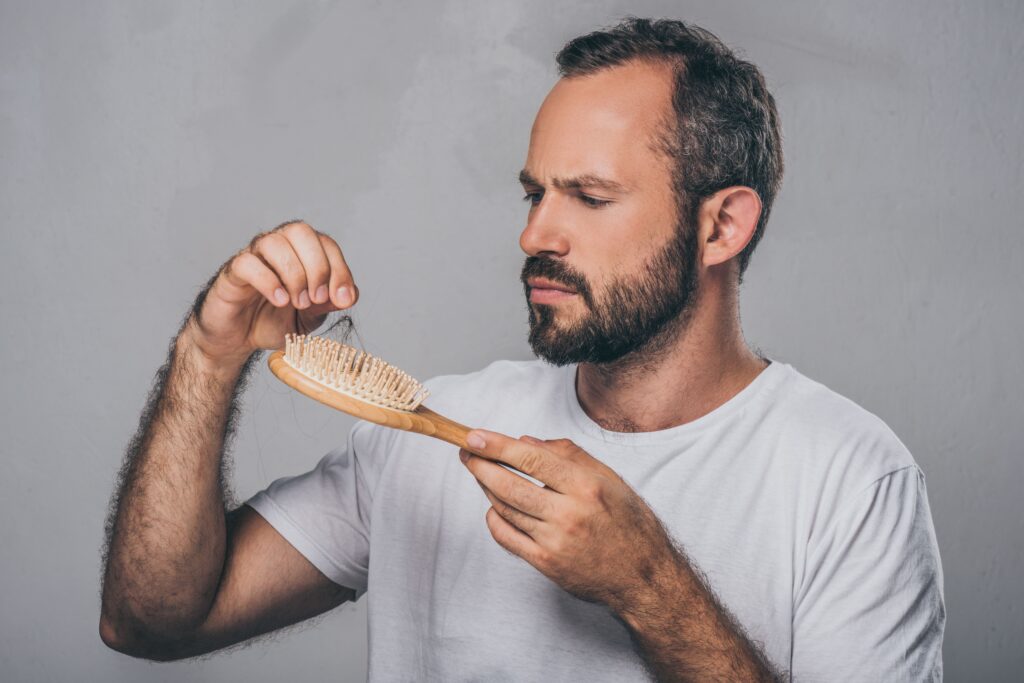 Man worries about his receding hairline and hair loss