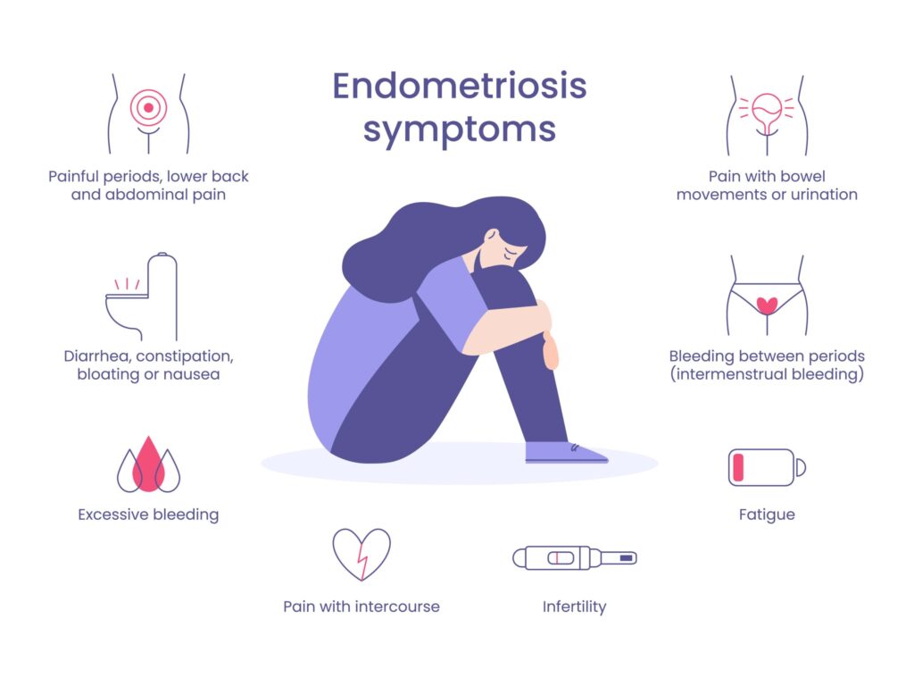 sintomi-endometriosi