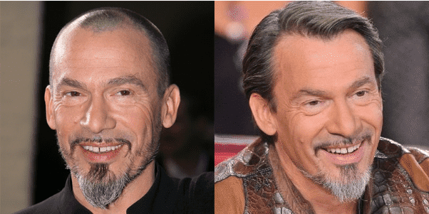 florent pagny calvitie