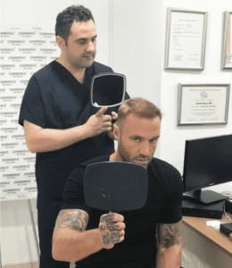 Calum Best greffe de cheveux