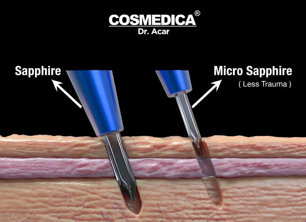 Trapianto capelli Turchia - incisioni zaffiro